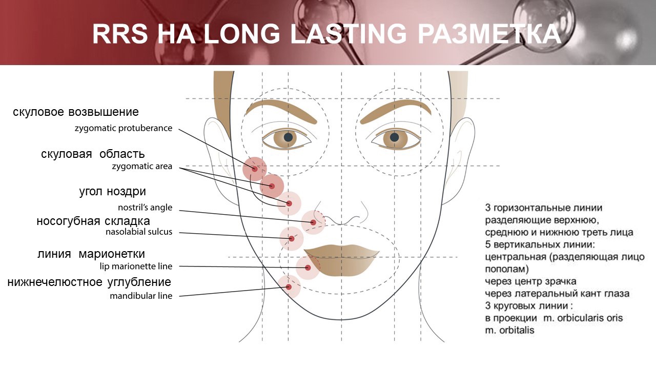 Rrs lasting. Лонг Ластинг биоревитализация. Точки для биоревитализации схема. RRS long lasting. RRS ha long lasting.