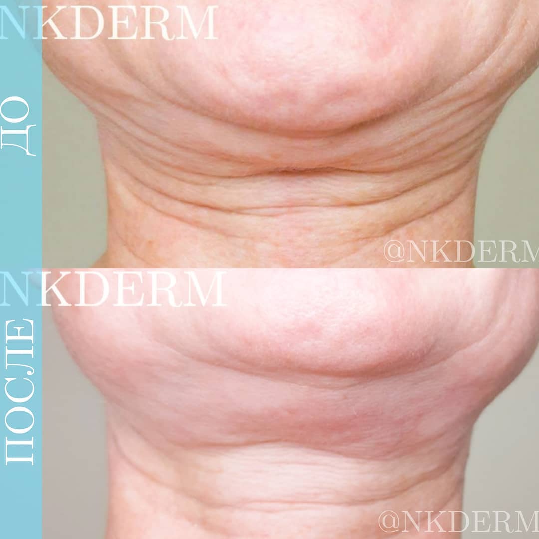 nkderm_105977229_2748338142052303_3122634734263459891_n