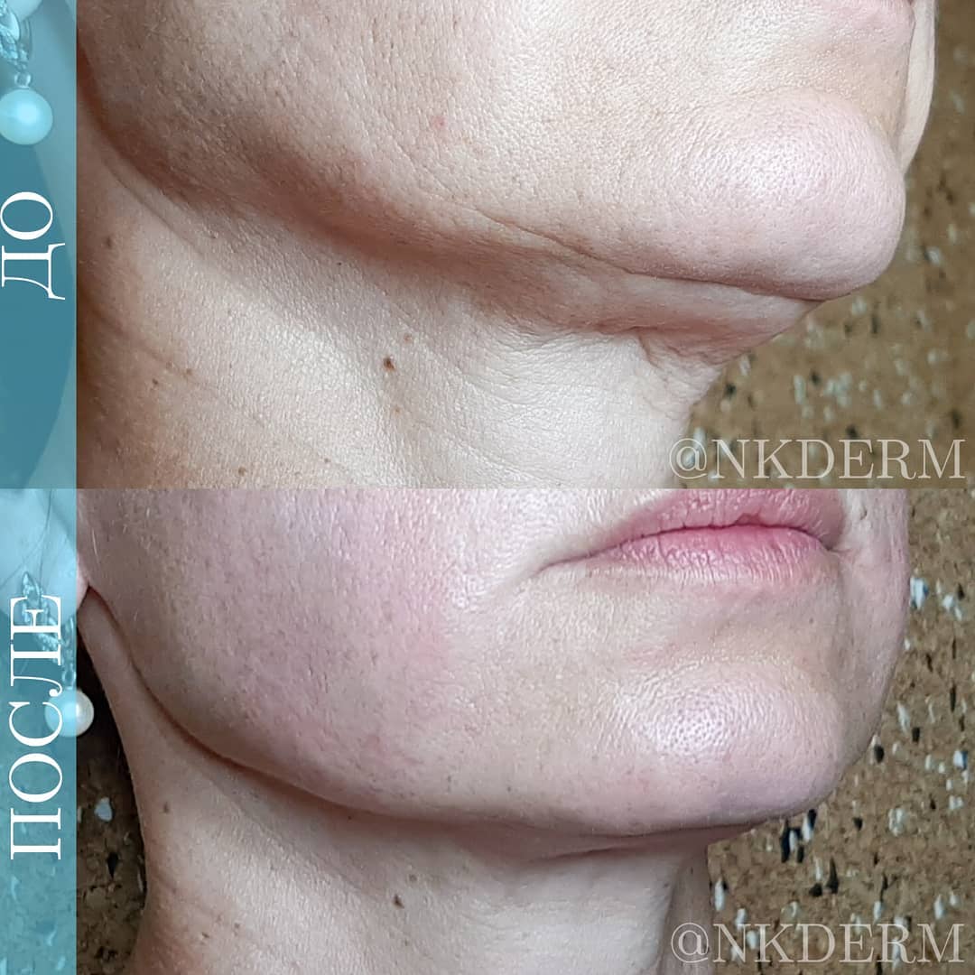 nkderm_116876914_310989596915089_212147784924872966_n