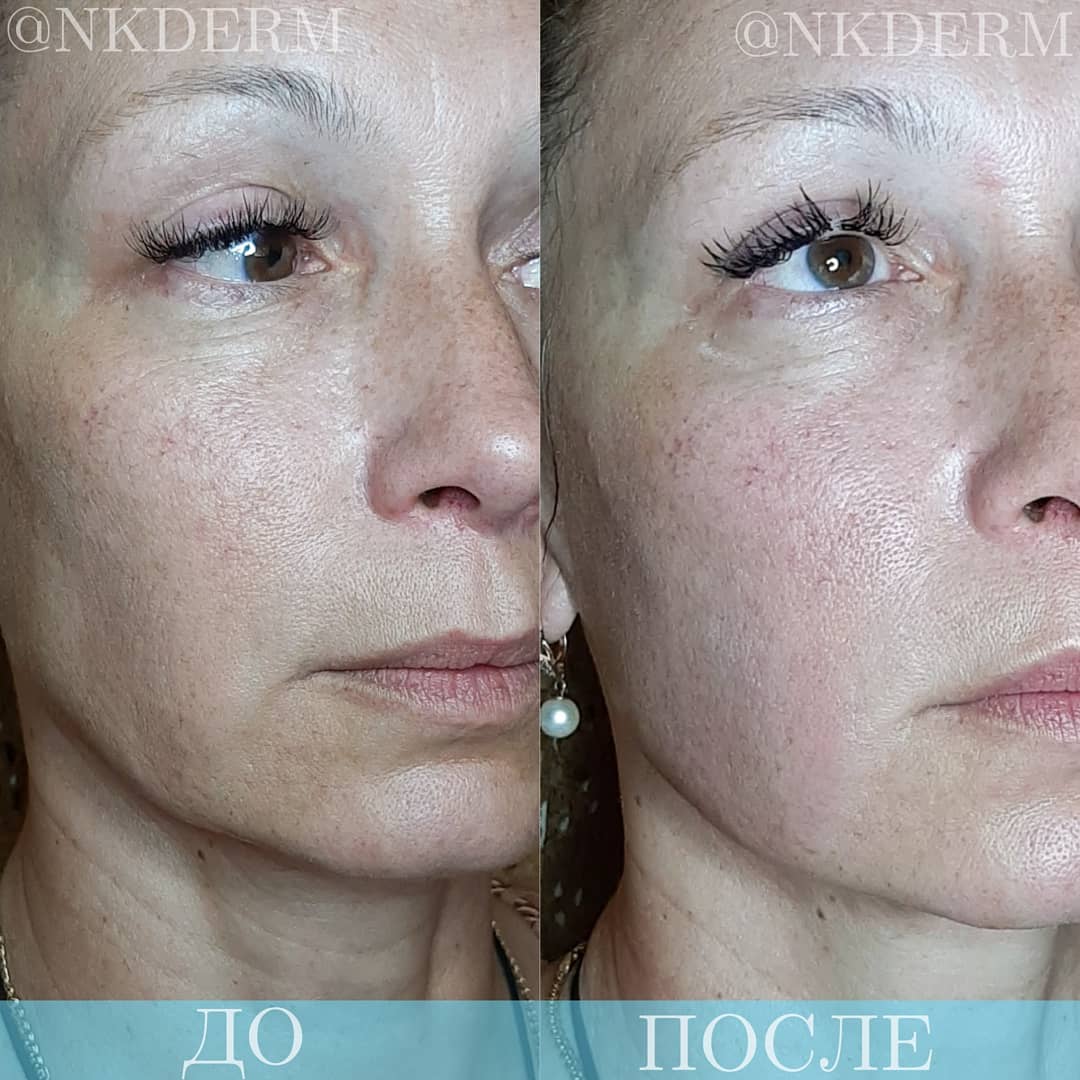 nkderm_124430694_1030848114048530_3562915502602181490_n