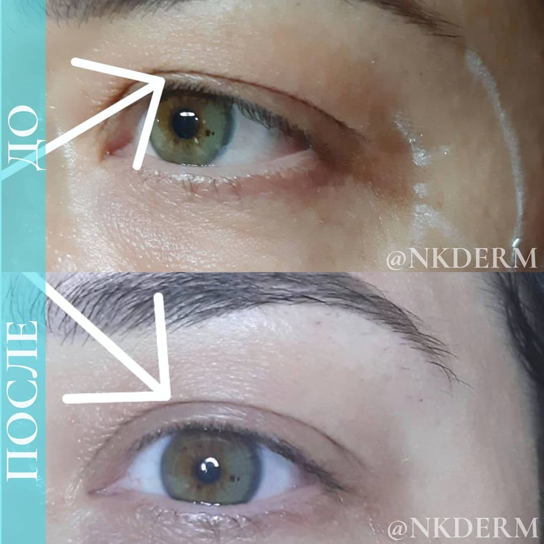 nkderm_129775863_118339213431728_5574907671666449519_n