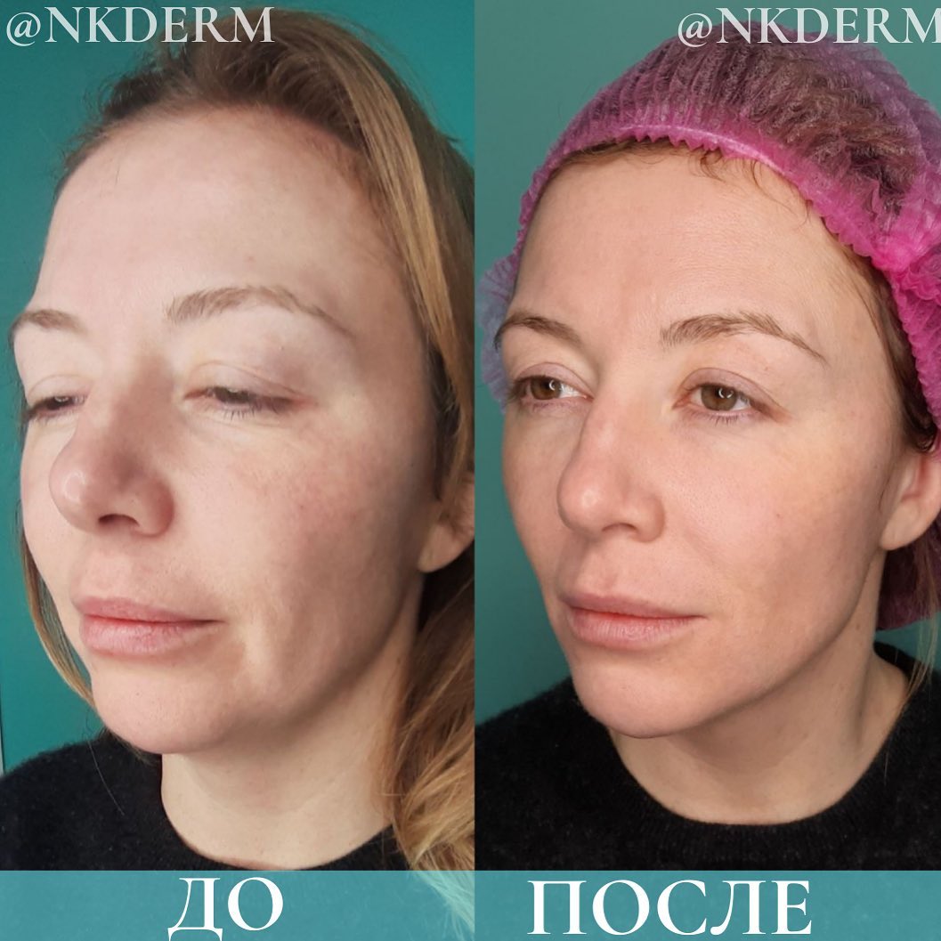 nkderm_160589662_347458369955655_7109815741116011829_n