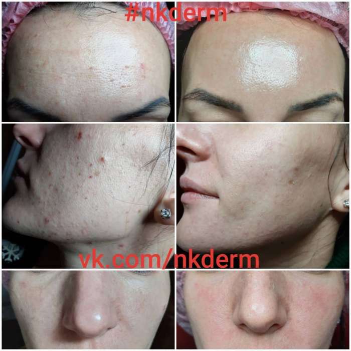 nkderm_46478057_371259323646455_798202249037890468_n nkderm_46478057_371259323646455_798202249037890468_n