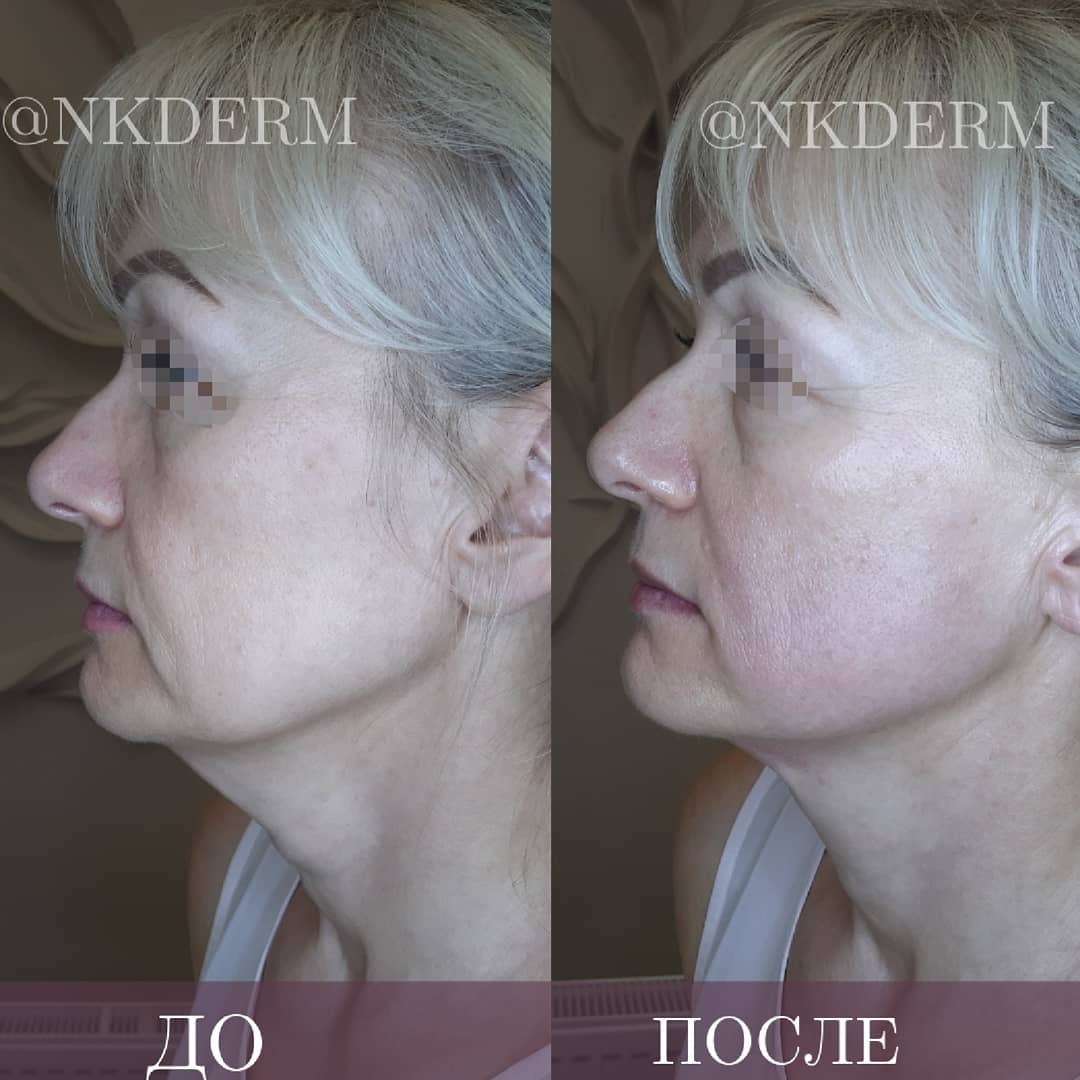 nkderm_60486434_332682514086691_4730548600102491973_n