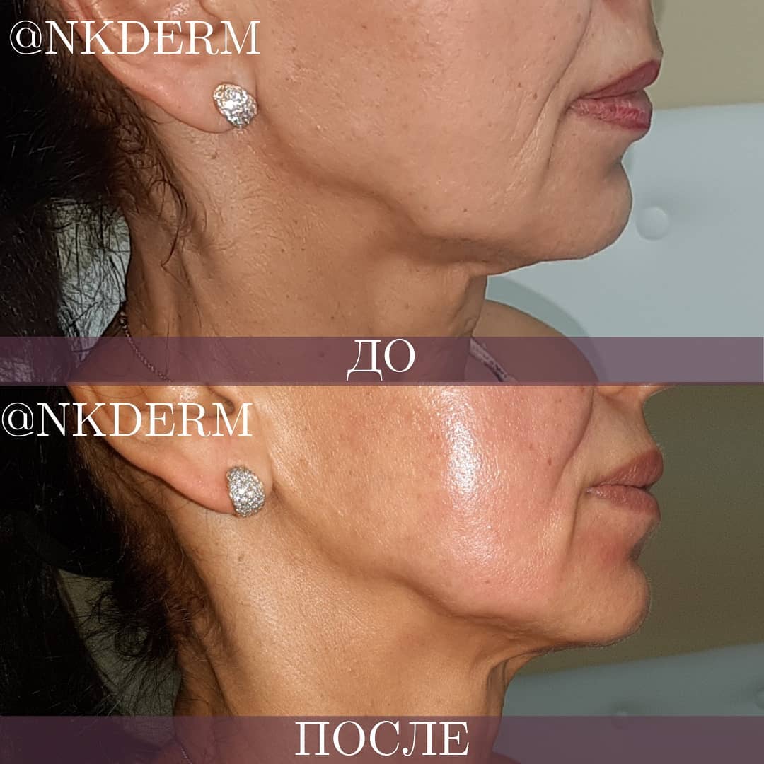 nkderm_64406199_338249000177122_6658130837562244123_n