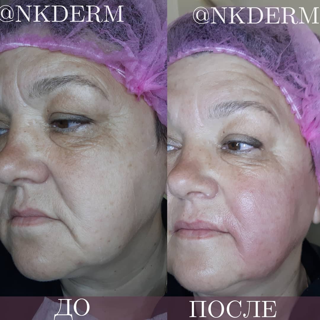 nkderm_64952539_322260065392295_7980521299226894286_n