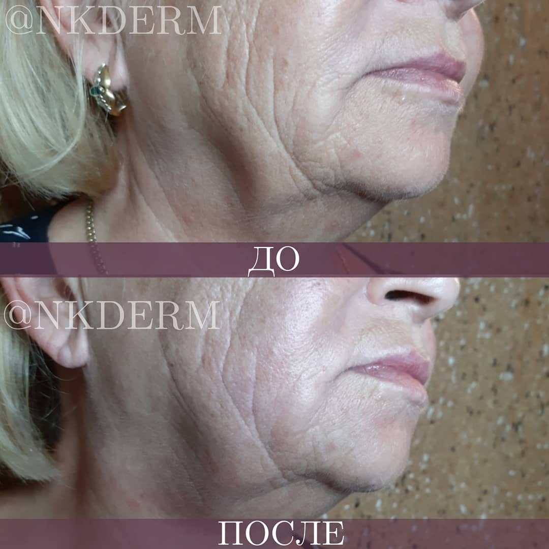 nkderm_66631284_2307644752651039_4338344035237834198_n