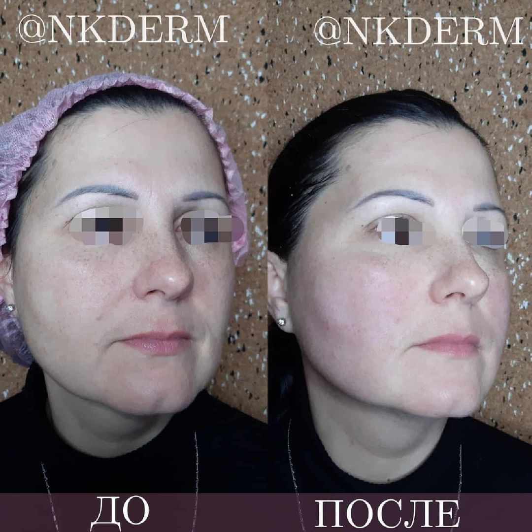 nkderm_75616322_583976652175276_4370772060052645338_n