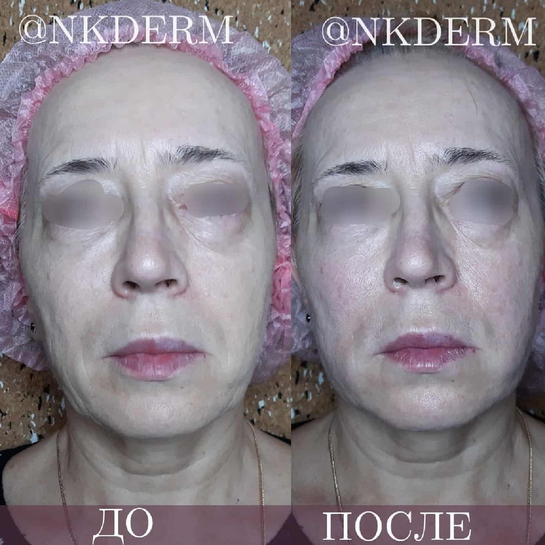 nkderm_79122664_248167812827622_2014013478467463898_n