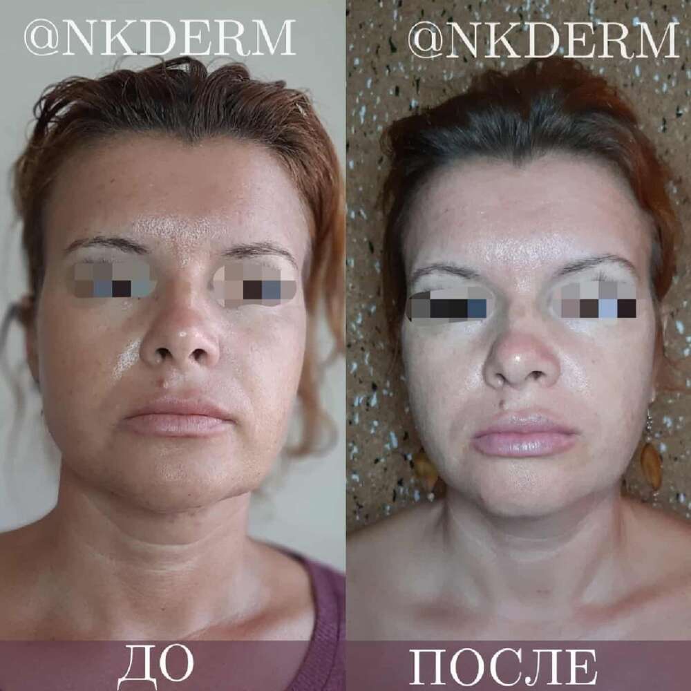 nkderm_79541580_1002831653435639_498121669991357419_n nkderm_79541580_1002831653435639_498121669991357419_n