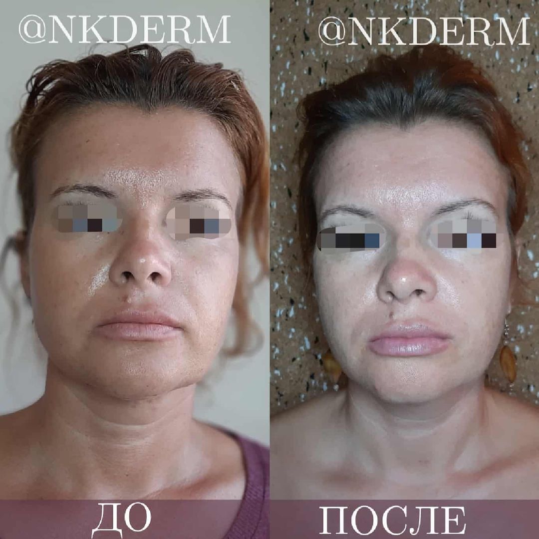 nkderm_79541580_1002831653435639_498121669991357419_n