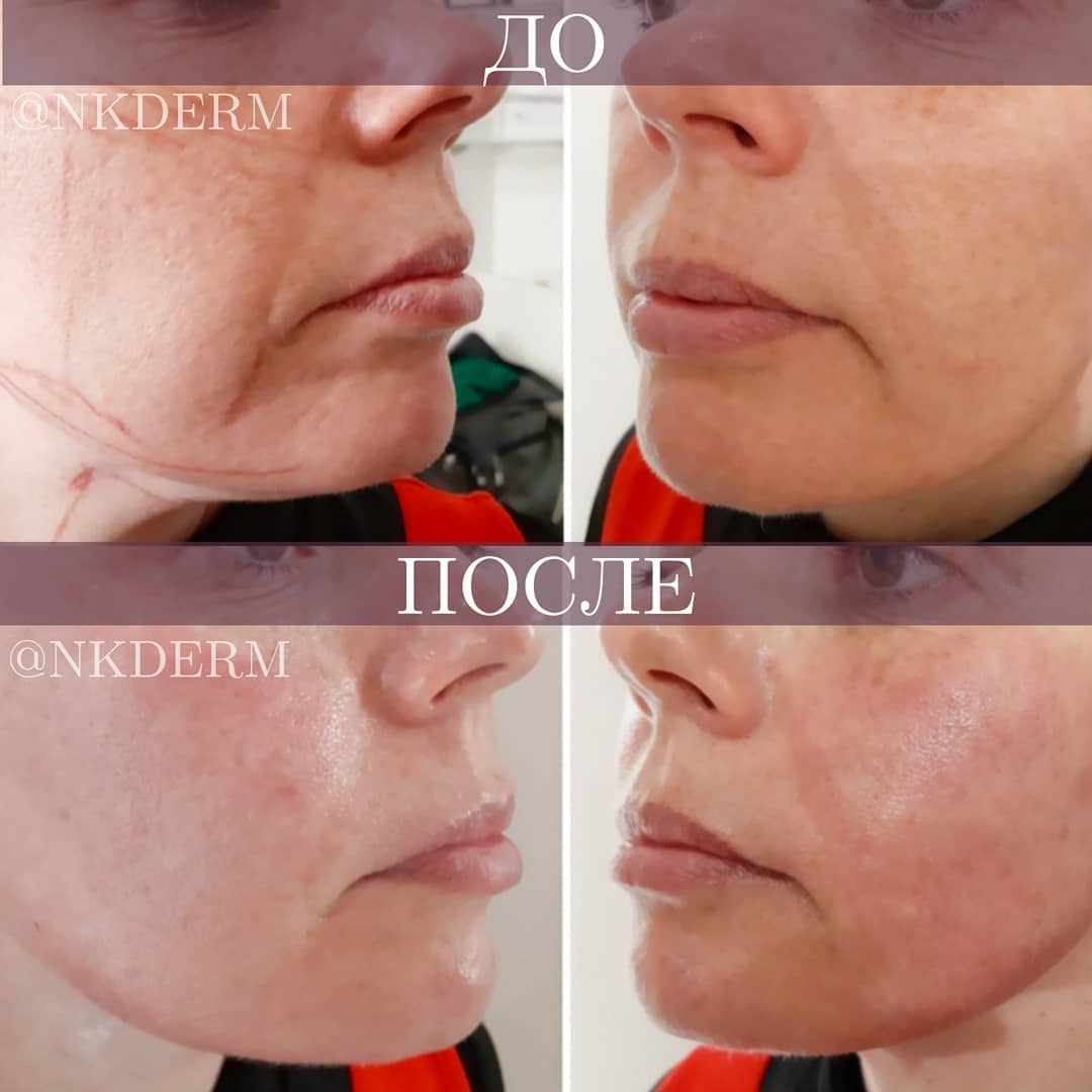 nkderm_84761846_1067413940271905_8310402619880393269_n