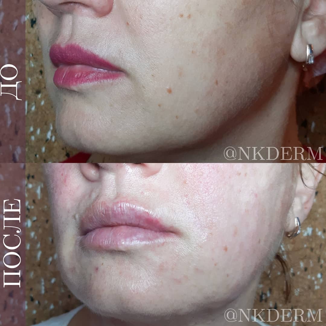 nkderm_87861832_847799492332575_8830450235151178388_n