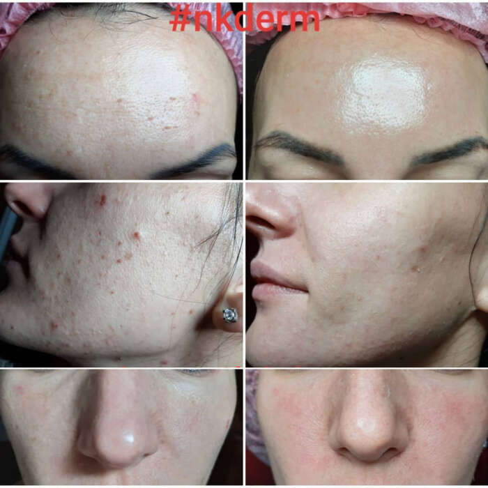 nkderm_46478057 nkderm_46478057